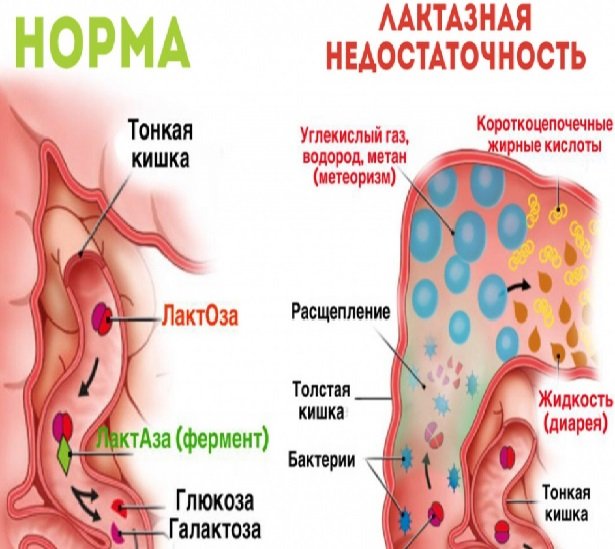 Предпосылки для анализа кала на углеводы