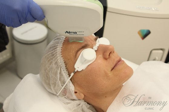 Топ-5 проблем, которые решает Harmony XL PRO