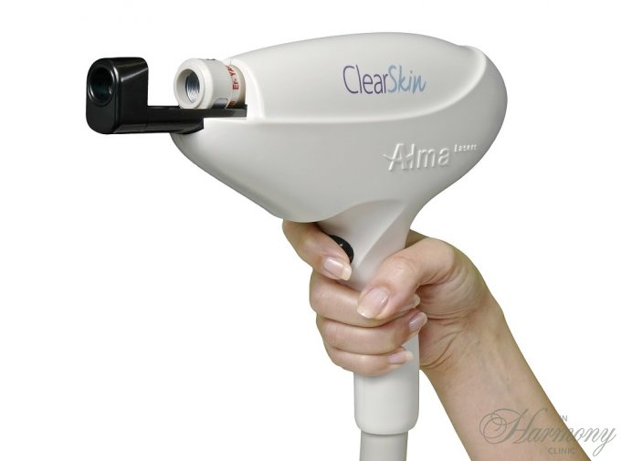 Лазерное омоложение без боли: как работает технология Clear Lift