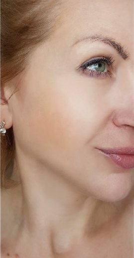 Биоревитализация лица после