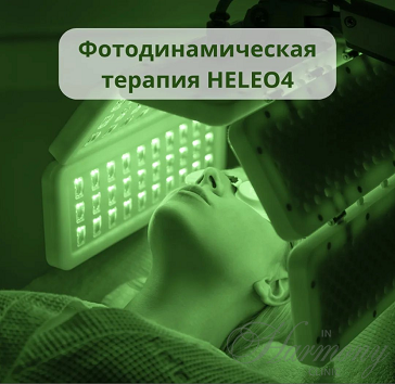 Фотодинамическая терапия HELEO4