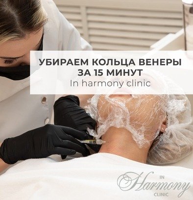 Убираем кольца венеры за 15 минут