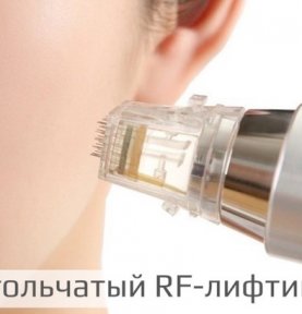 Игольчатый RF-лифтинг – топ предложение к Новому Году